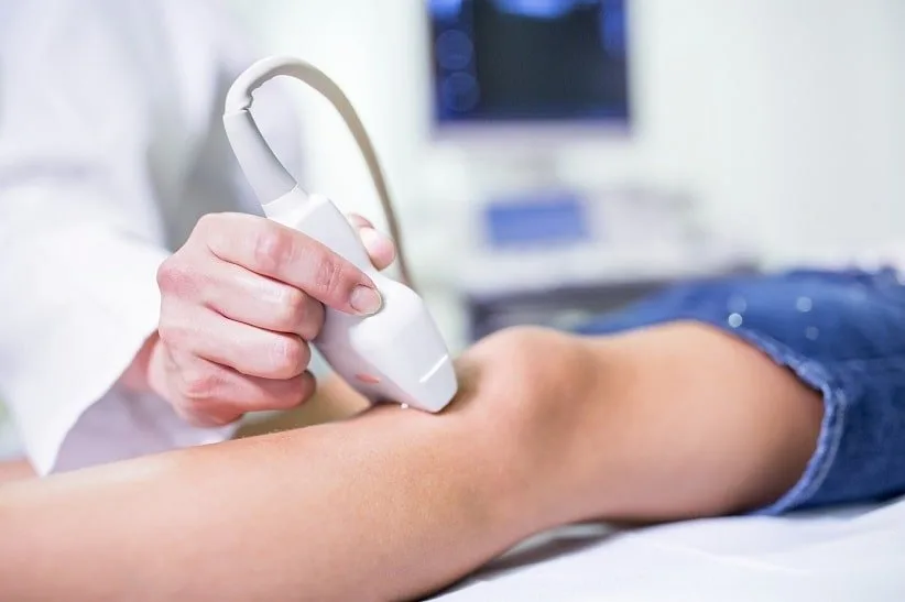 سونوگرافی داپلر برای تشخیص DVT
